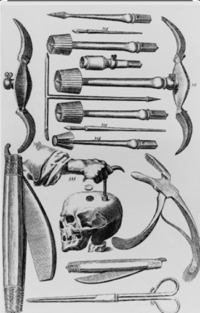 Historical trephining